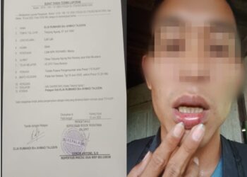 Dua Bulan Kasus Kades Tanjung Agung Belum Ada Kepastian Hukum, Korban: Ini Bukan Kemerdekaan!